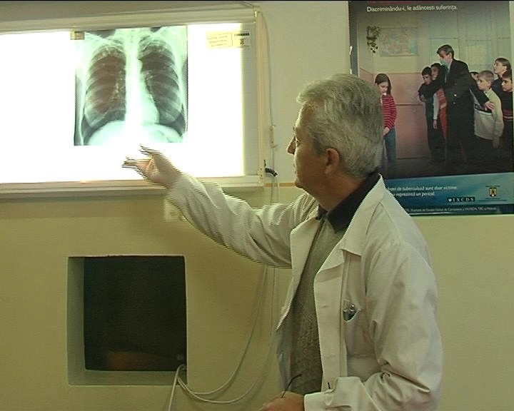 dispensar-de-tbc-redeschis-la-sacele