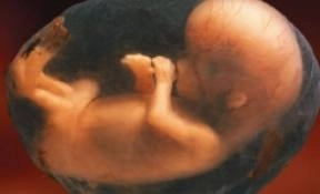 investigatii-obligatorii-pentru-depistarea-virusului-hiv