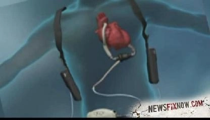 un-om-traieste-fara-inima-de-sase-luni