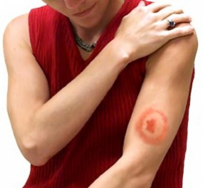 atacurile-capuselor-sau-intetit-la-brasov-