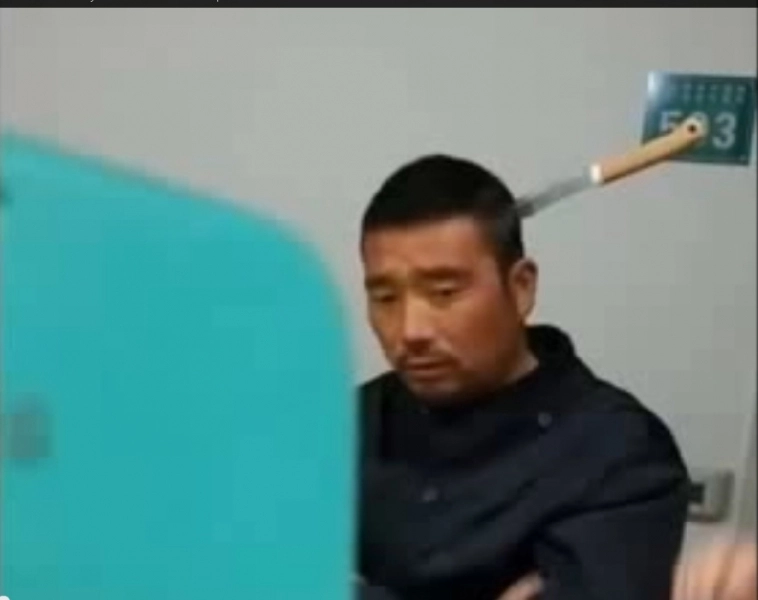 cu-cutitul-infipt-in-creier-ma-poate-vedea-un-doctor-video