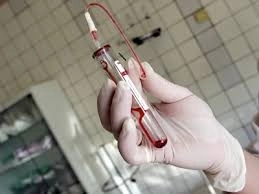 cum-afli-gratuit-daca-ai-hepatita