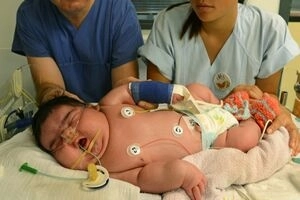 cum-arata-bebelusul-gigantic-de-peste-6-kg