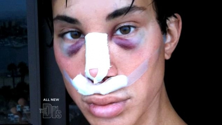 drama-barbatului-cu-128-de-operatii-estetice-foto-video