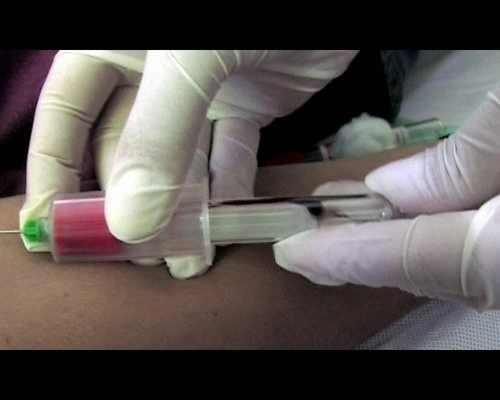 teste-gratuite-pentru-hepatita-c