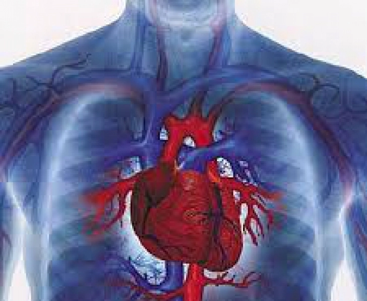 boala-care-ucide-60-dintre-romani