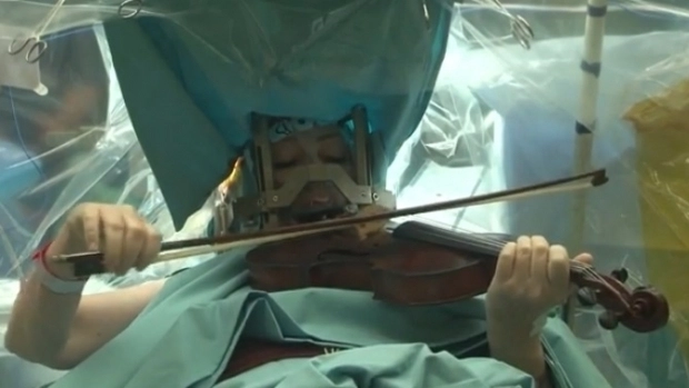 in-timp-ce-era-operata-pe-creier-a-cantat-mozart-la-vioara