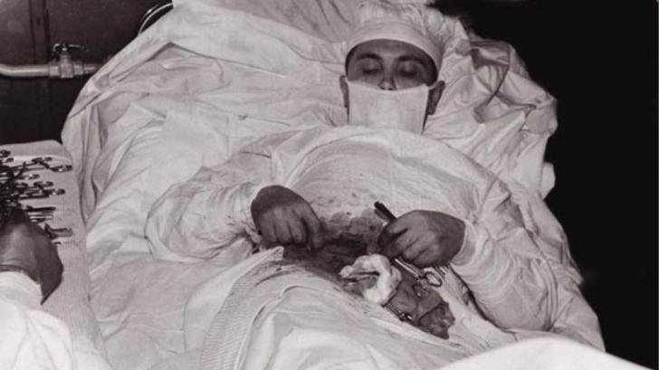 incredibil-un-chirurg-sa-operat-singur-de-apendicita