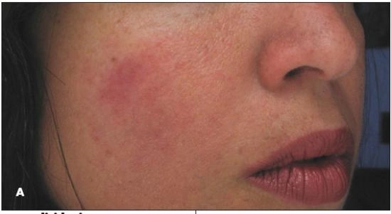 mii-de-paraziti-traiesc-pe-fata-noastra