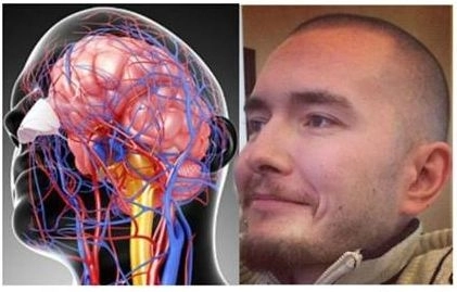 -se-pregateste-primul-transplant-de-cap-din-lume