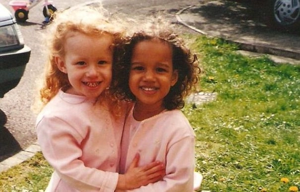 fenomen-bizar-povestea-gemenelor-care-nu-seamana-nici-macar-in-privinta-culorii-pielii