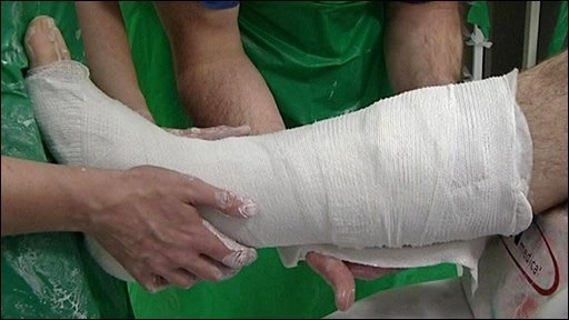medic-ortoped-din-brasov-condamnat-la-inchisoare-