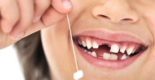 pastrati-dintii-de-lapte-ai-copiilor-din-ei-se-pot-recolta-celule-stem