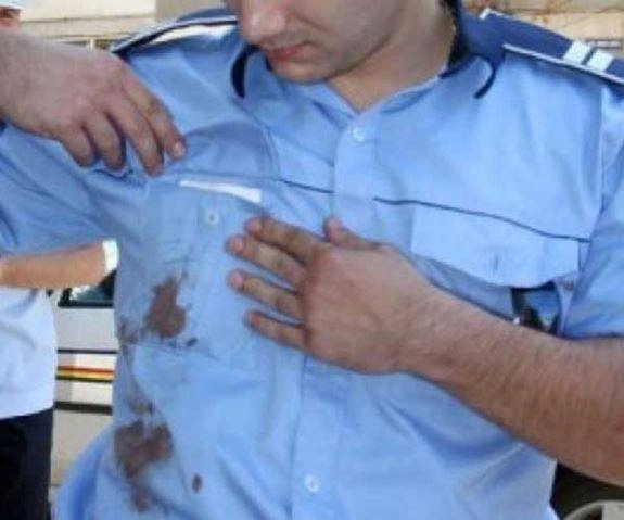 politist-brasovean-snopit-in-bataie-si-lovit-cu-o-vaza-si-cu-un-pahar