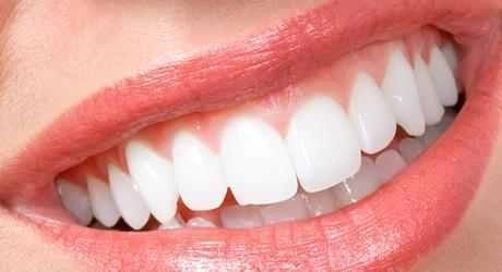 solutii-naturale-pentru-a-avea-dinti-sanatosi