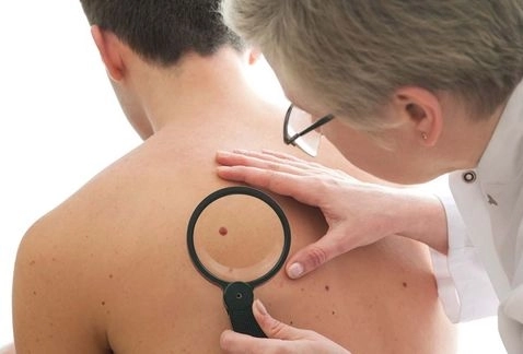 teste-gratuite-pentru-alunite