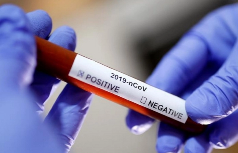 -03-august-2020-bilant-covid19-la-brasov-30-de-infectati-in-ultimele-24-de-ore