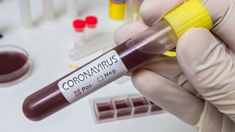 4-august-de-trei-ori-mai-multe-infectari-cu-covid19-decat-in-ziua-precedenta-la-brasov