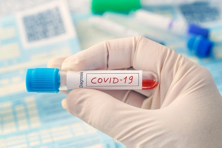 ministerul-sanatatii-propune-ca-farmaciile-sa-poata-realiza-teste-rapide-pentru-depistarea-covid19
