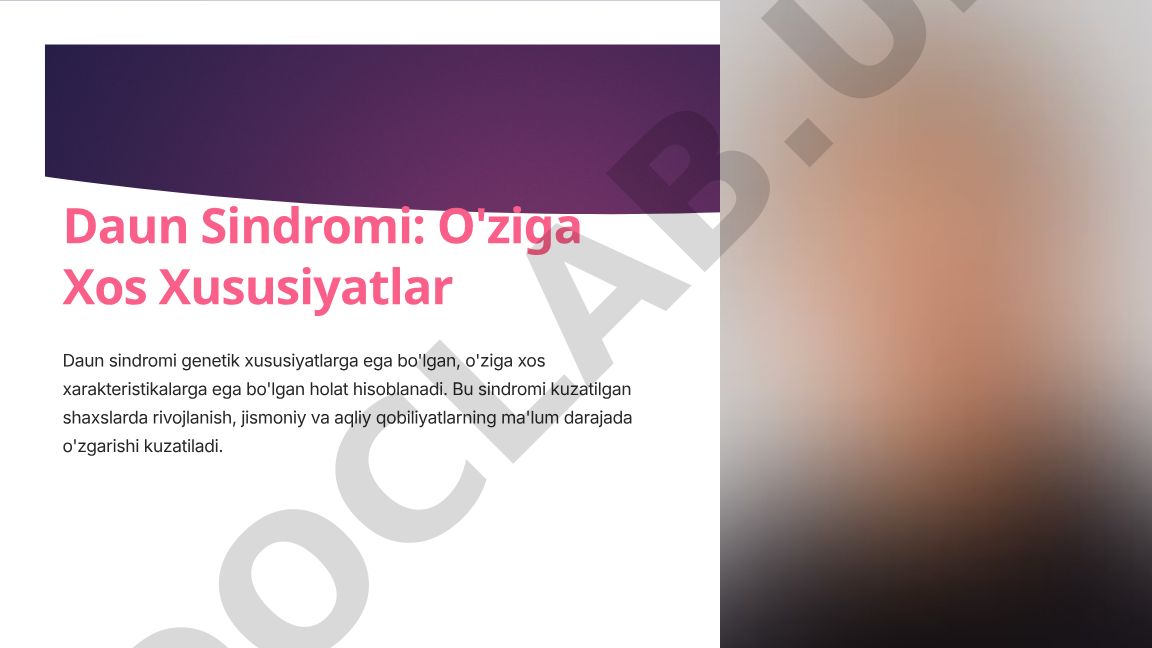 Daun Sindromi: O'ziga Xos Xususiyatlar