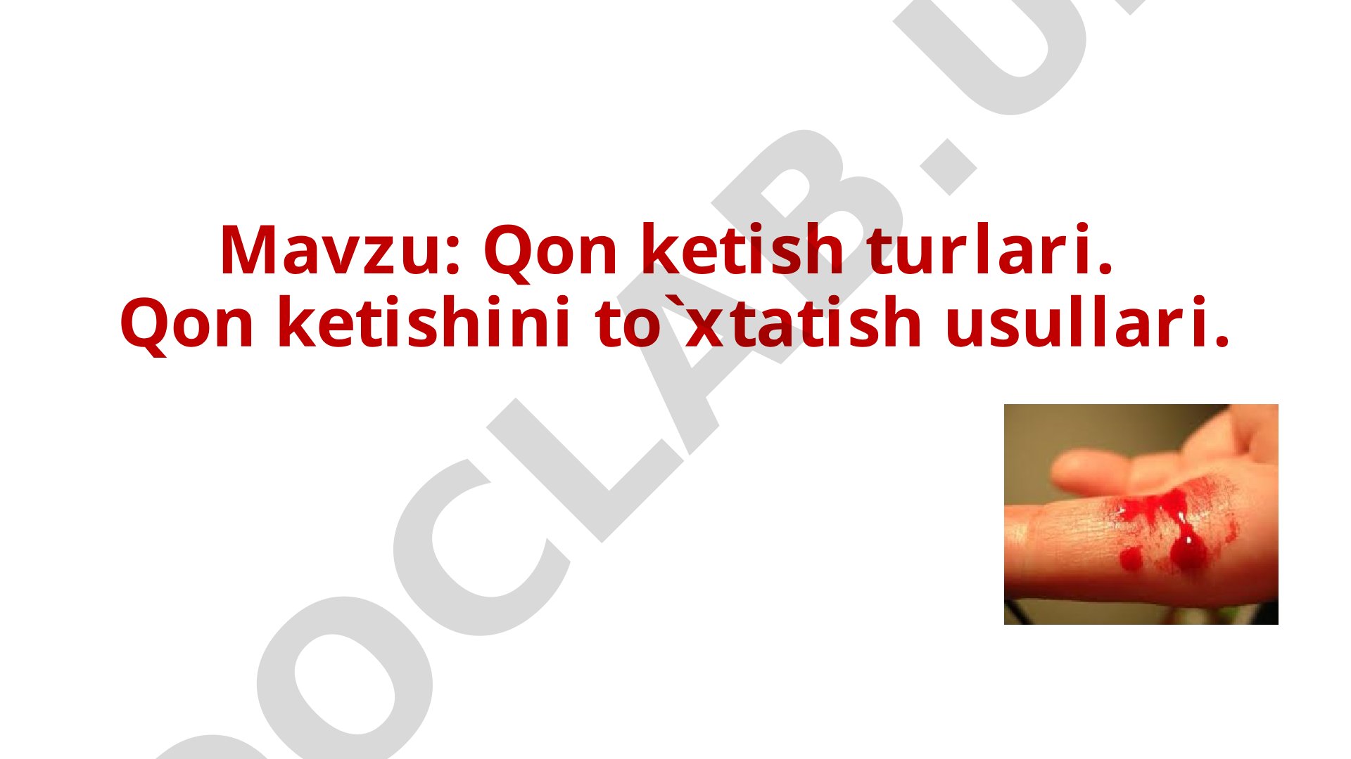 Qon ketish turlari va ularni to'xtatish usullari