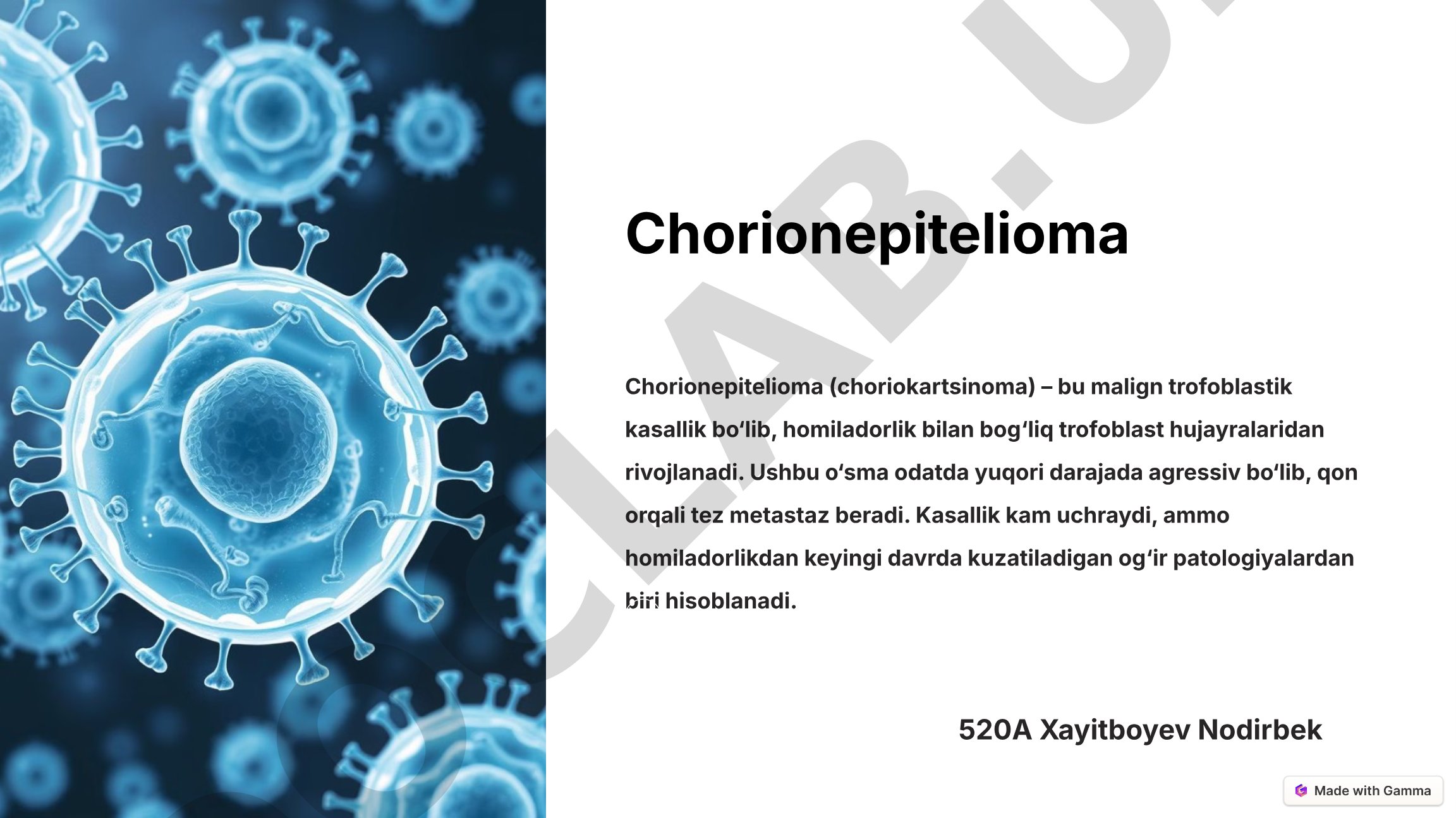 Chorionepitelioma (choriokartsinoma) malign trofoblastik kasallik