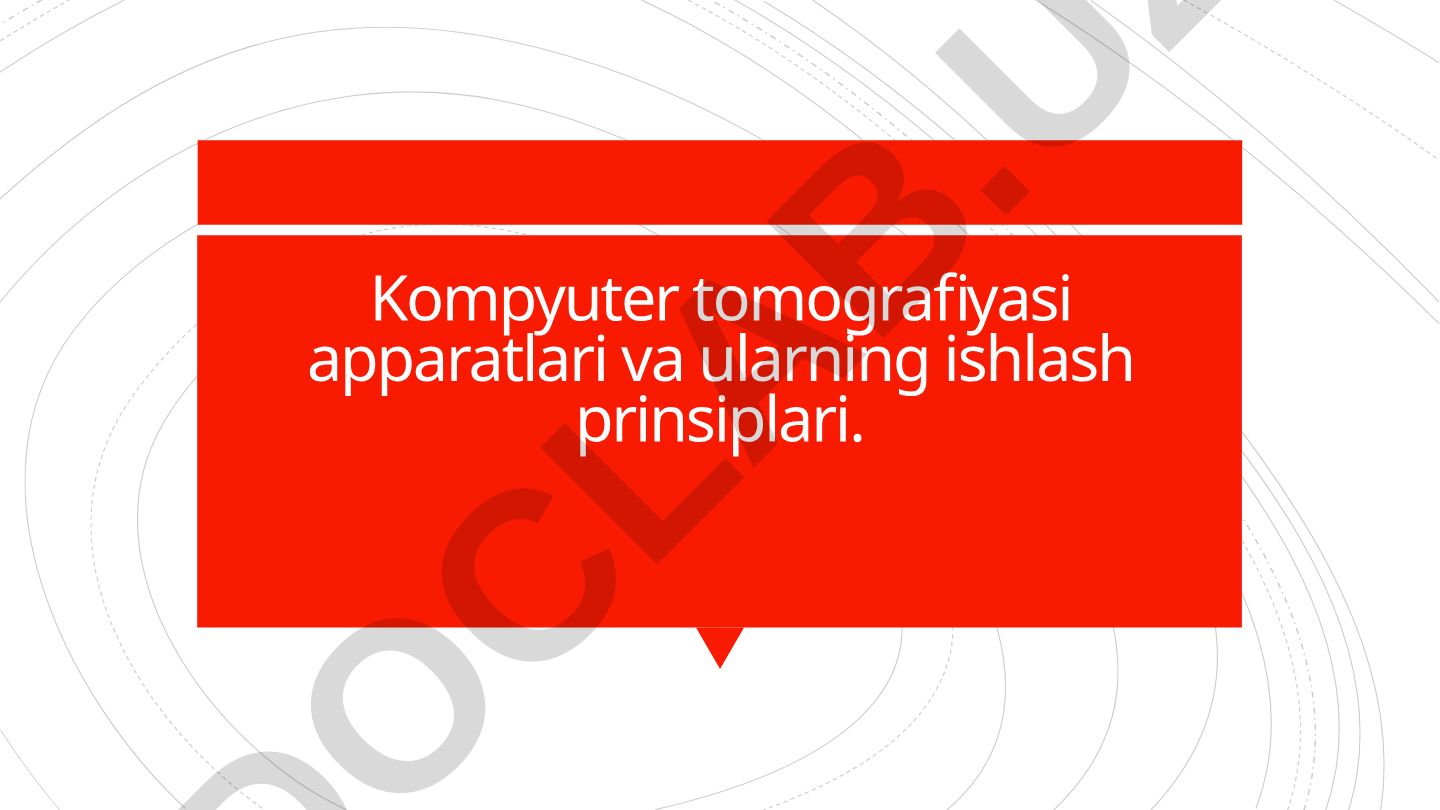 Kompyuter tomografiyasi apparatlari va ularning ishlash prinsiplari