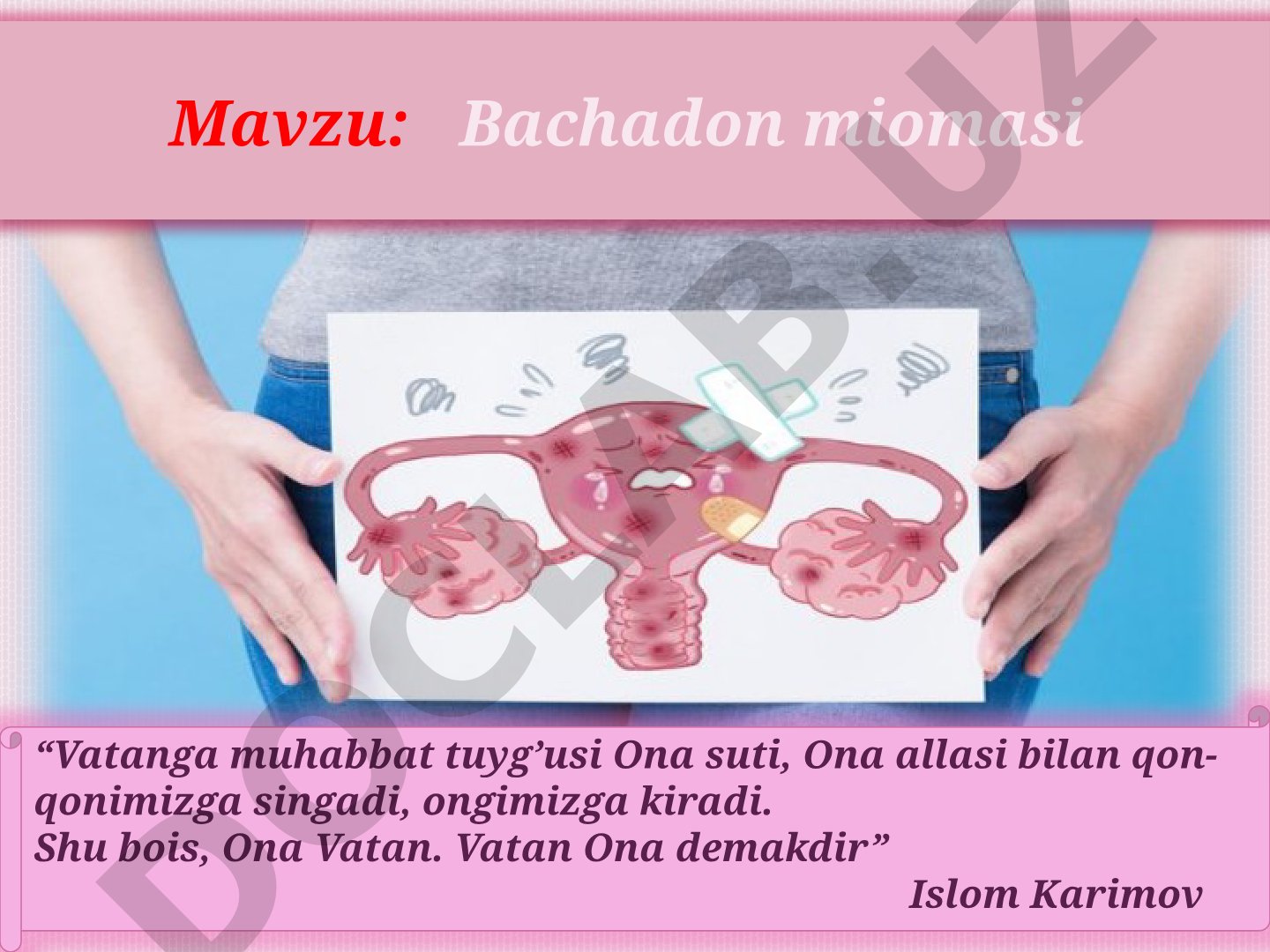 Bachadon miomasi tasnifi, etiopatogenez, klinik belgilar, tashxislash, davolash, profilaktika