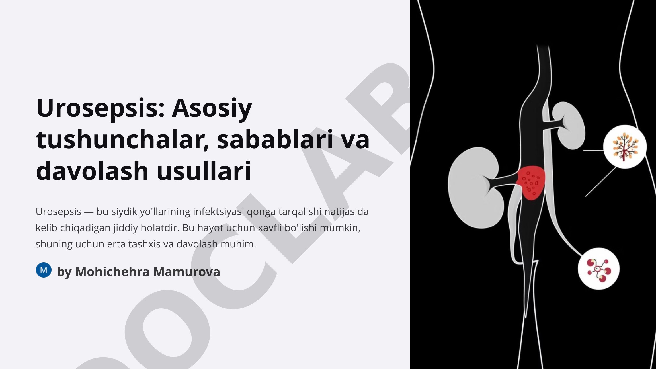 Urosepsis: Asosiy tushunchalar va davolash