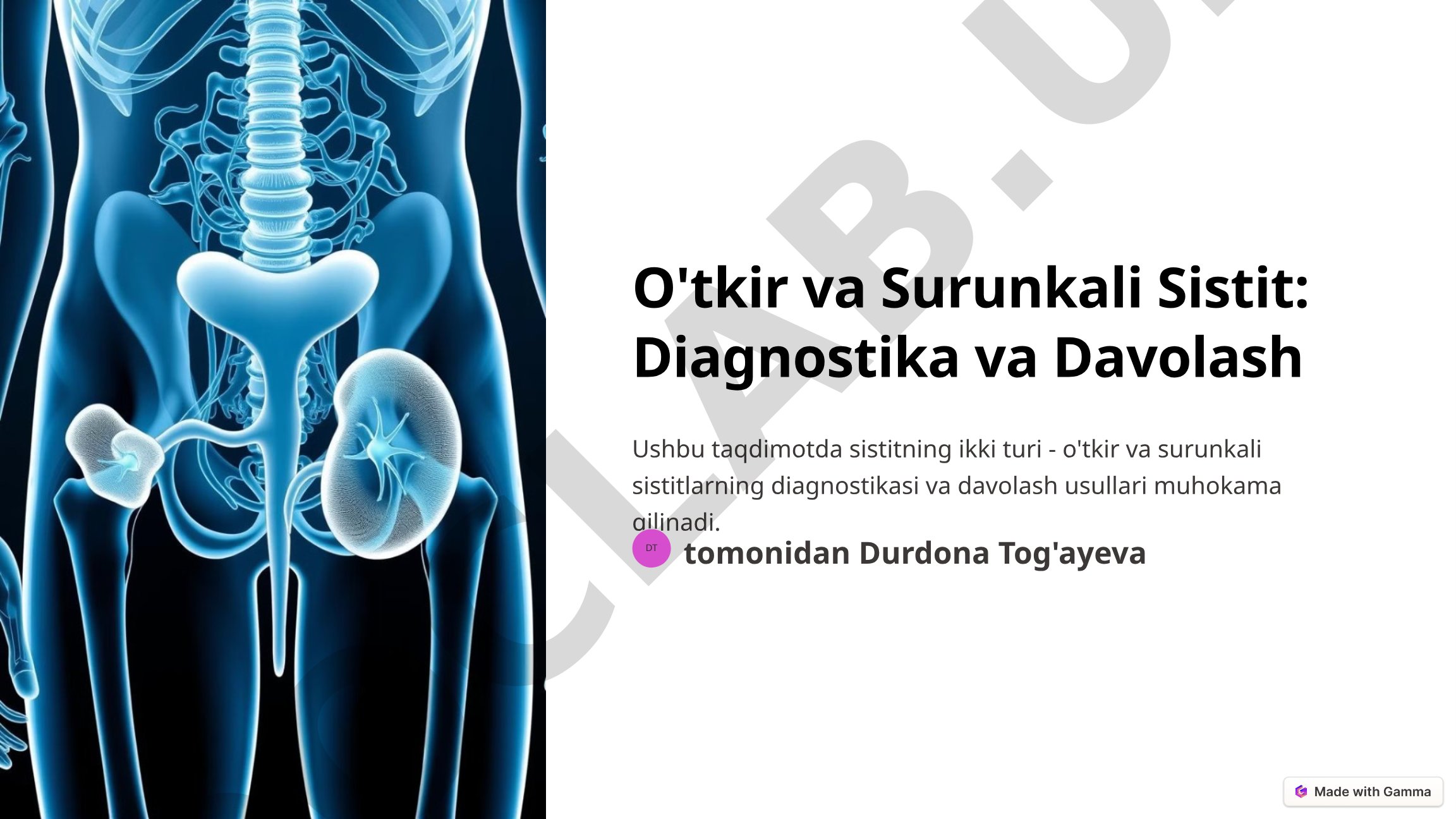 Sistit Diagnostika va Davolash Taqdimoti