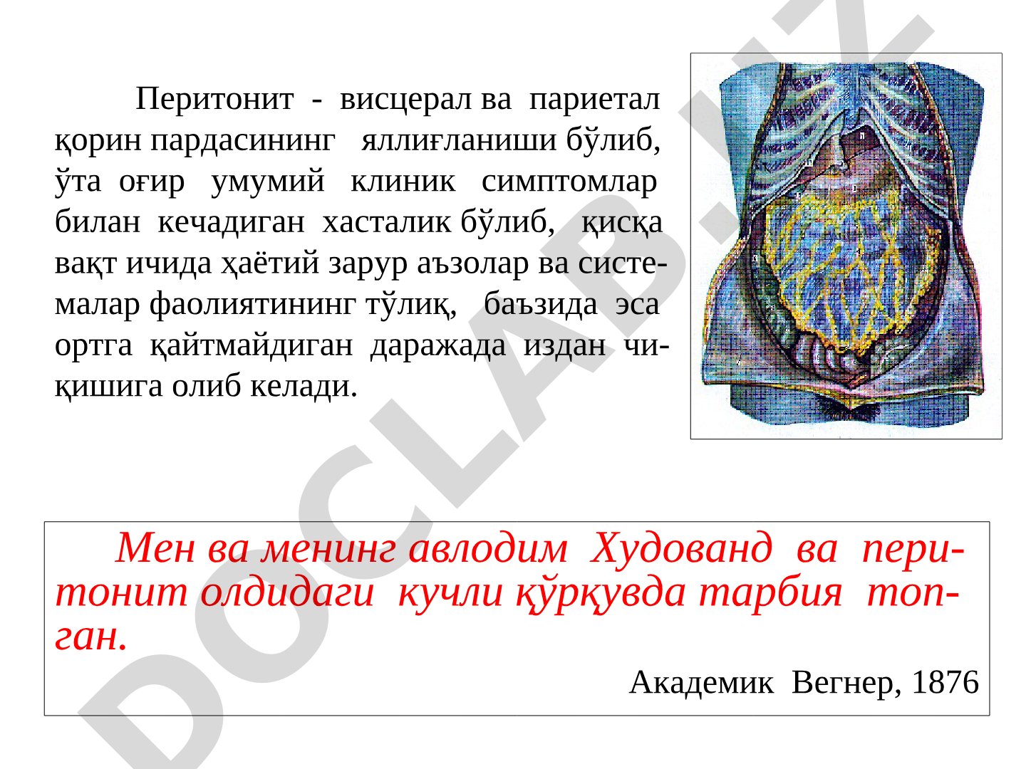 Перитонит: этиология, классификация, клинические признаки
