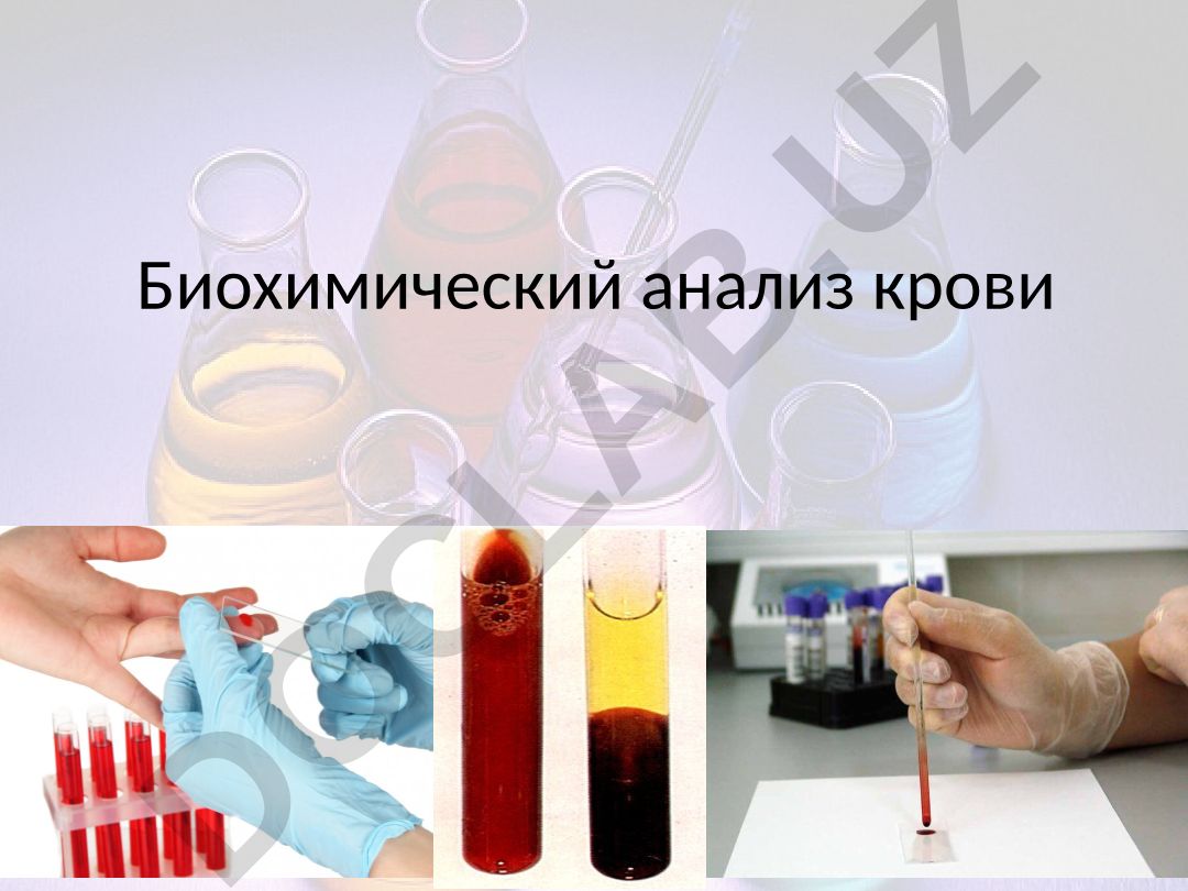 Биохимический анализ крови: подготовка, показатели и нормы