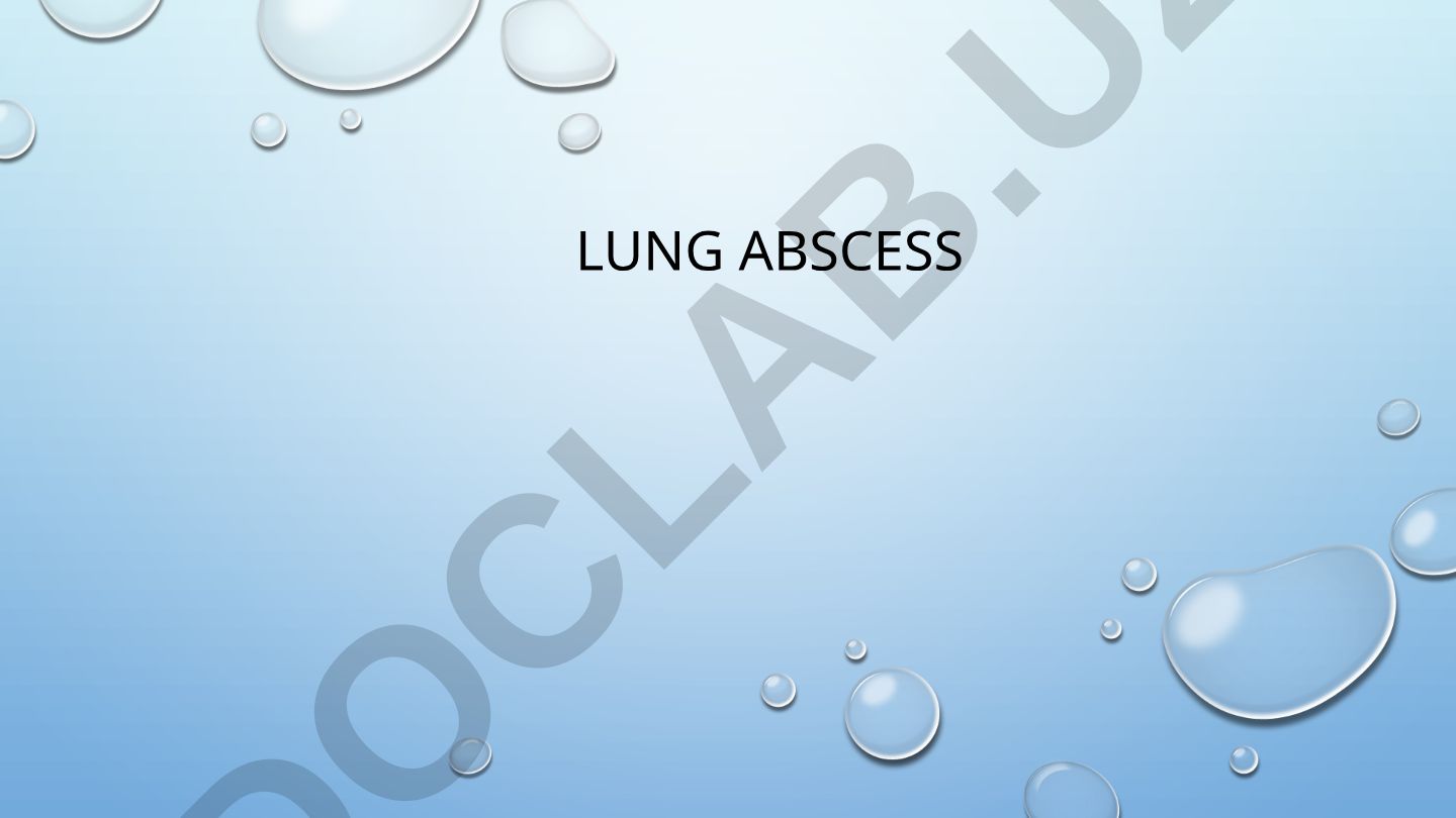 Lung abscess causes signs treatment and respiratory system