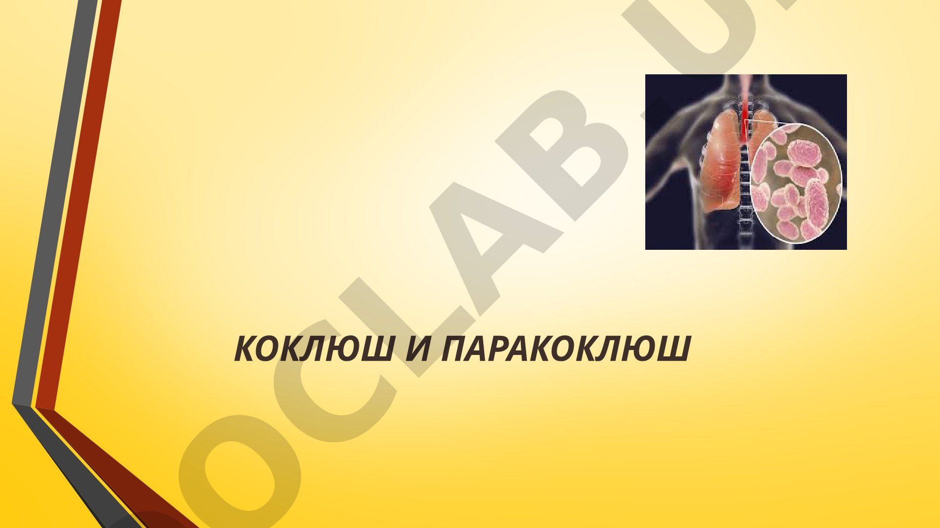 Лекция о коклюше и паракоклюше: этиология, эпидемиология, клиника, диагностика
