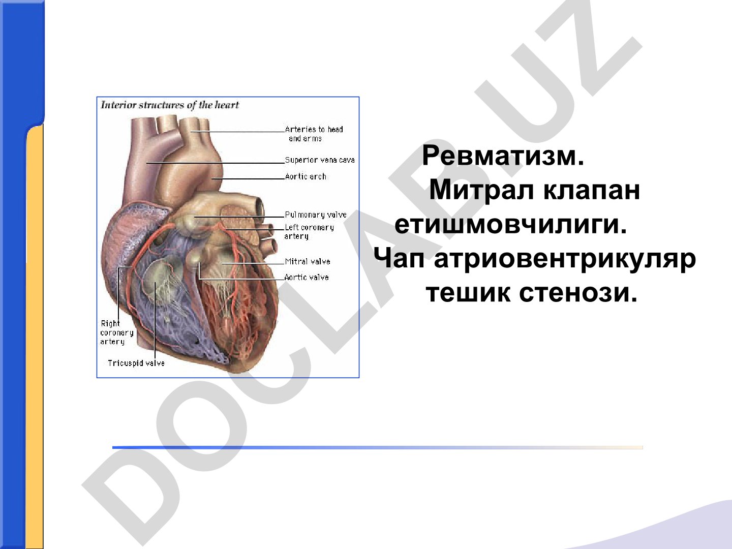 Ревматизм: этиология, классификация и клинические проявления