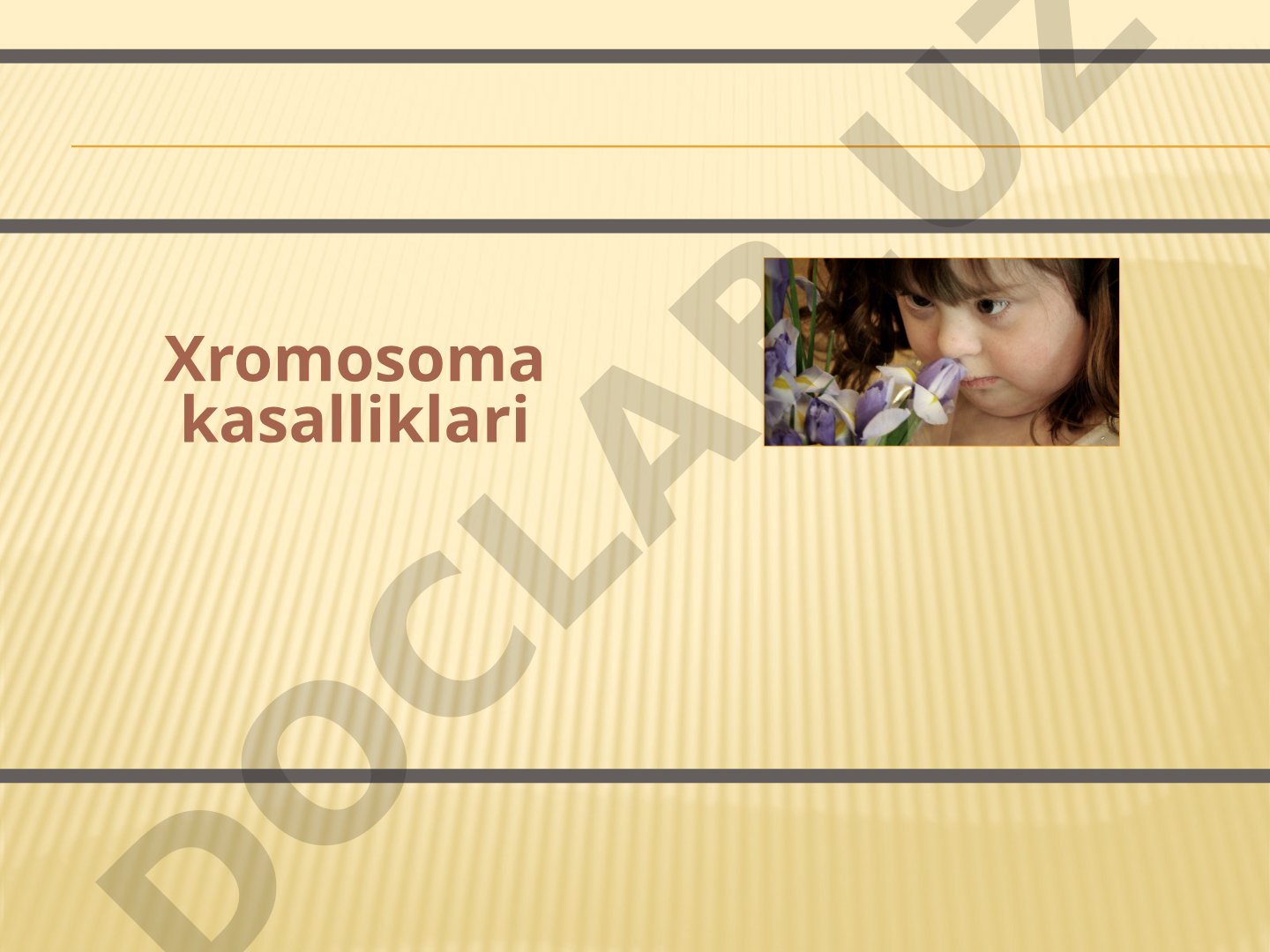 Xromosoma kasalliklari: etiologiya, patogenez va klinik ko'rinish