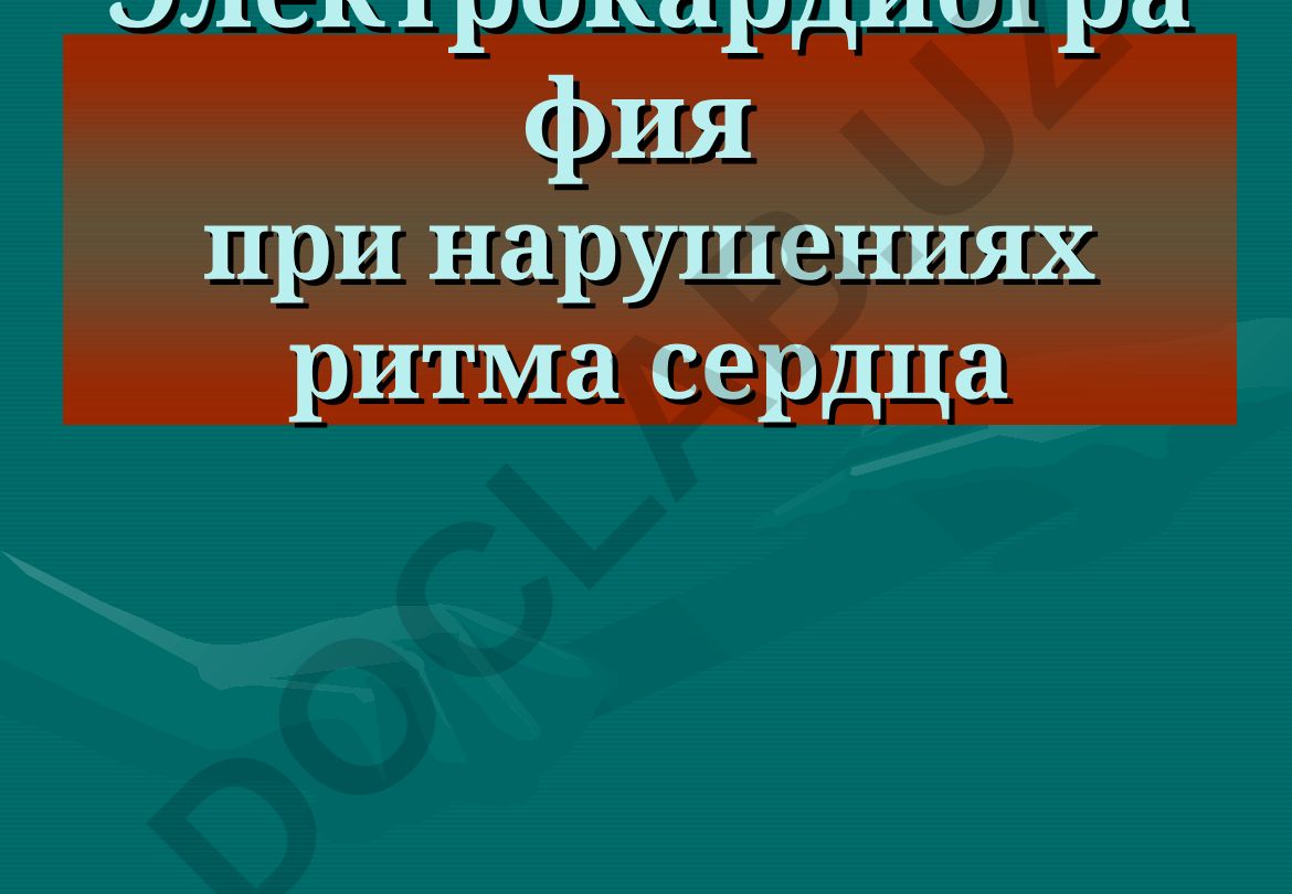 Электрокардиография при нарушениях ритма сердца