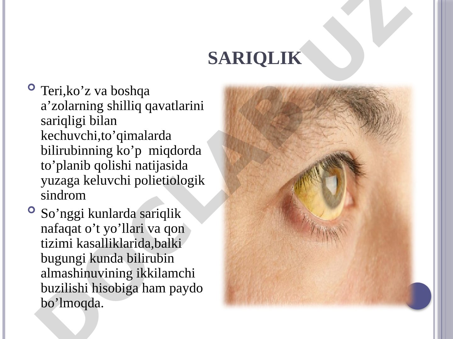 Sariqlik sindromi, bilirubin almashinuvi, sariqlik turlari va gemolitik sariqlik haqida
