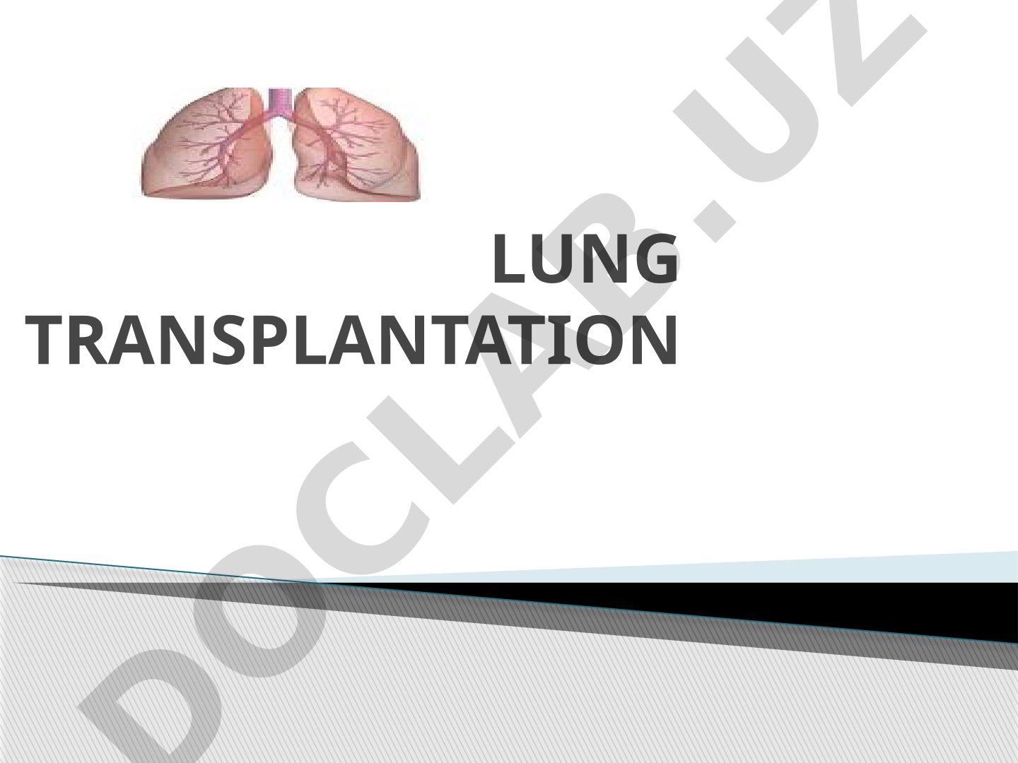 Lung Transplantation Learning