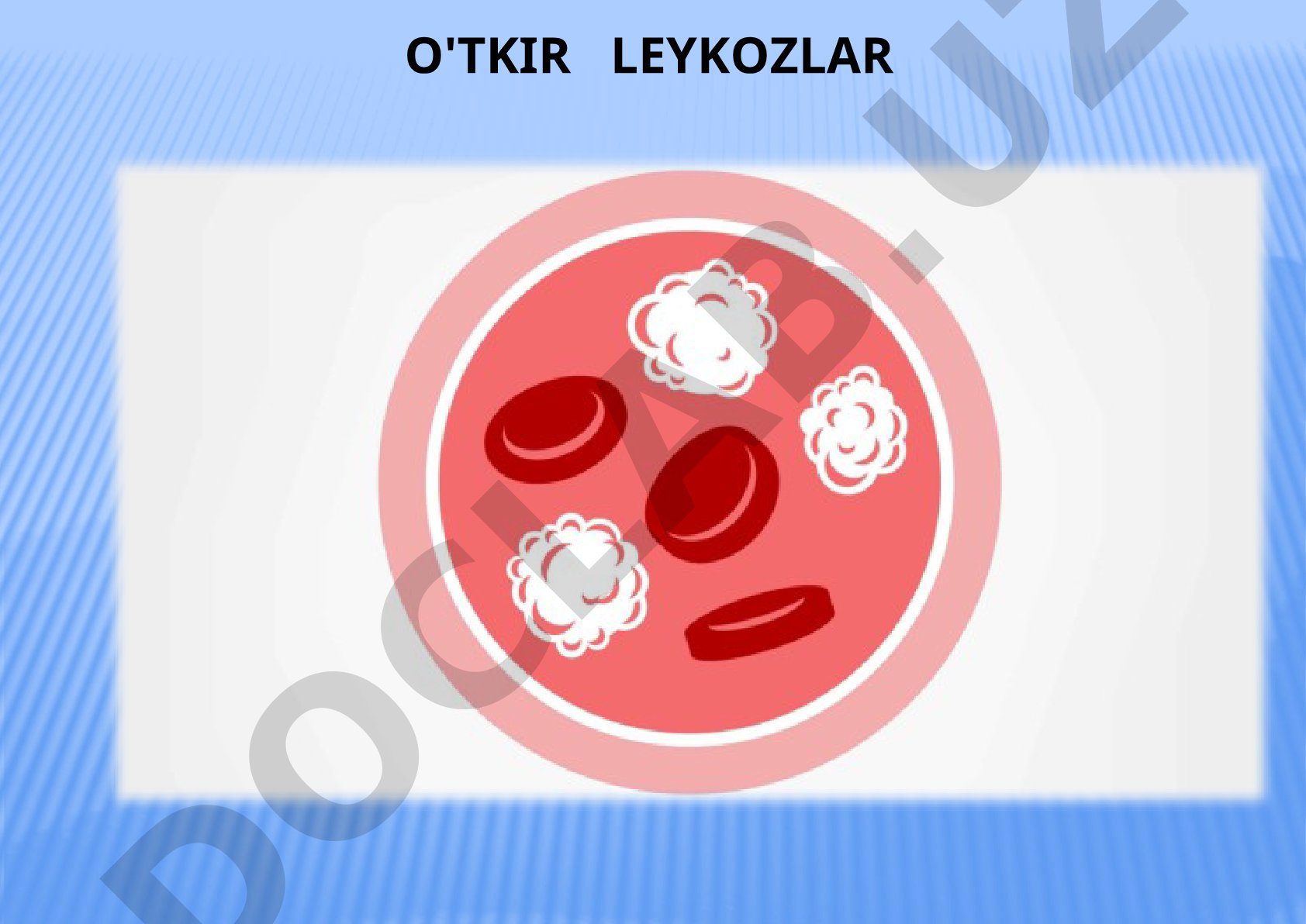 Bolalarda o'tkir leykoz kasalligi