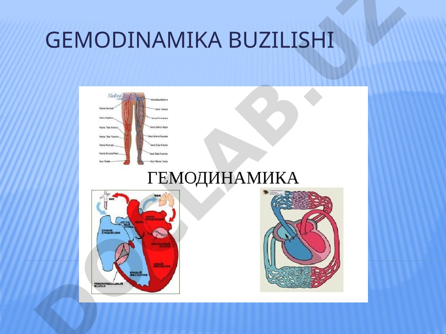 Gemodinamika buzilishi