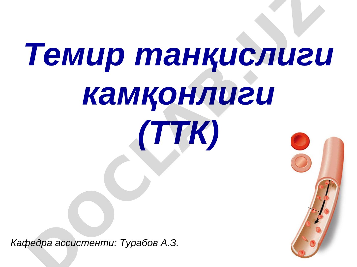 Темир танқислиги камқонлиги (ТТК)