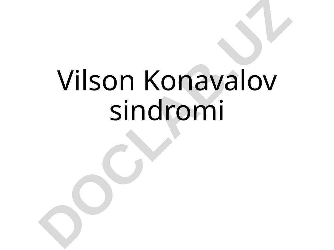 Vilson Konavalov sindromi