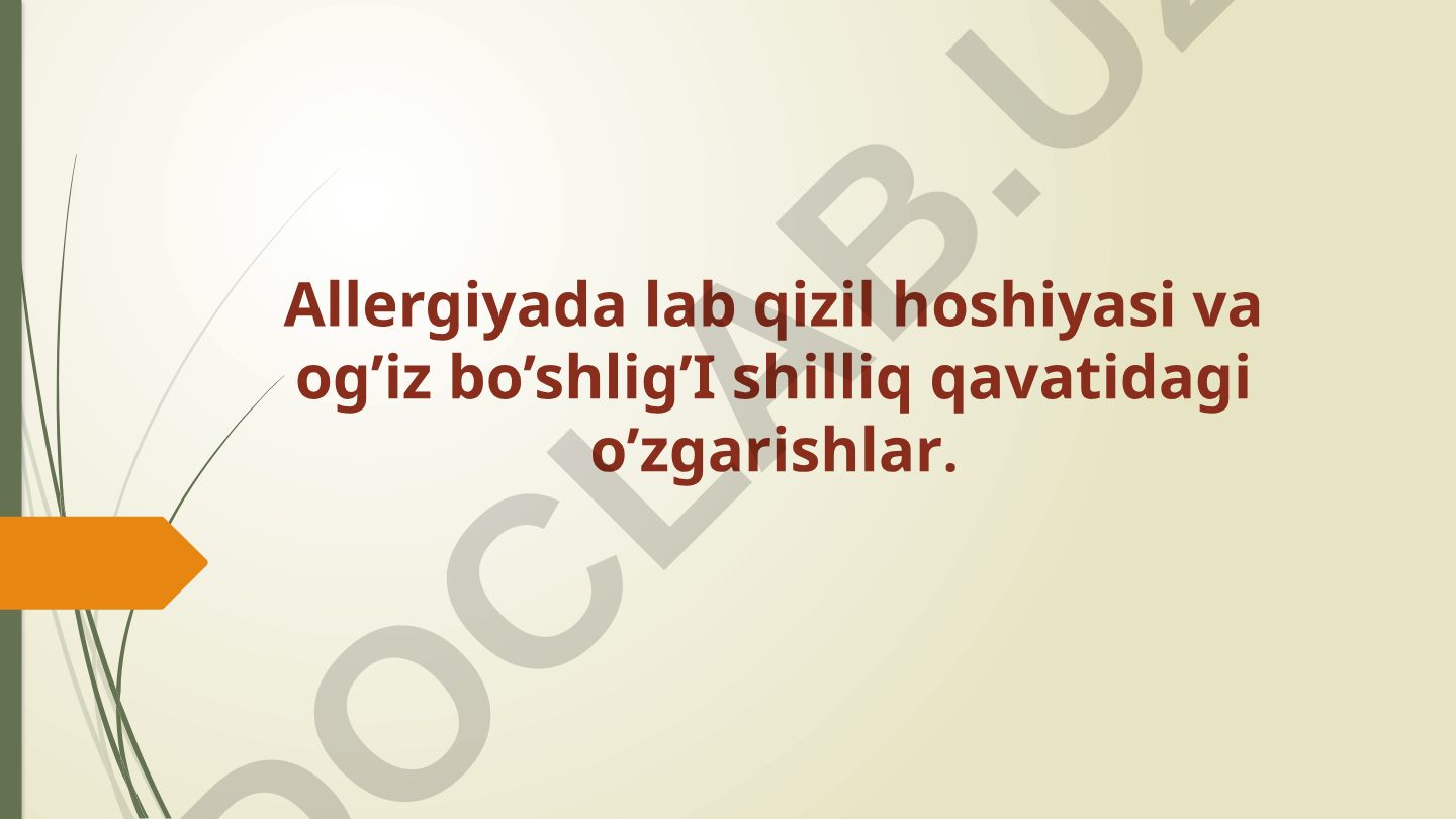 Allergik kasalliklar va og'iz bo'shlig'i shilliq qavatidagi o'zgarishlar