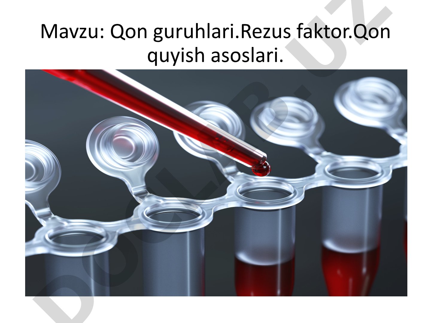 Qon guruhlari. Rezus faktor. Qon quyish asoslari