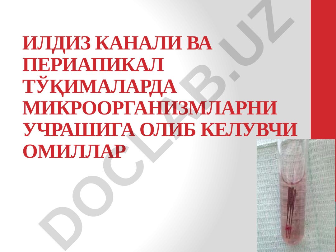 Илдиз канали ва периапикал тўқималарда микроорганизмларни учрашига олиб келувчи омиллар