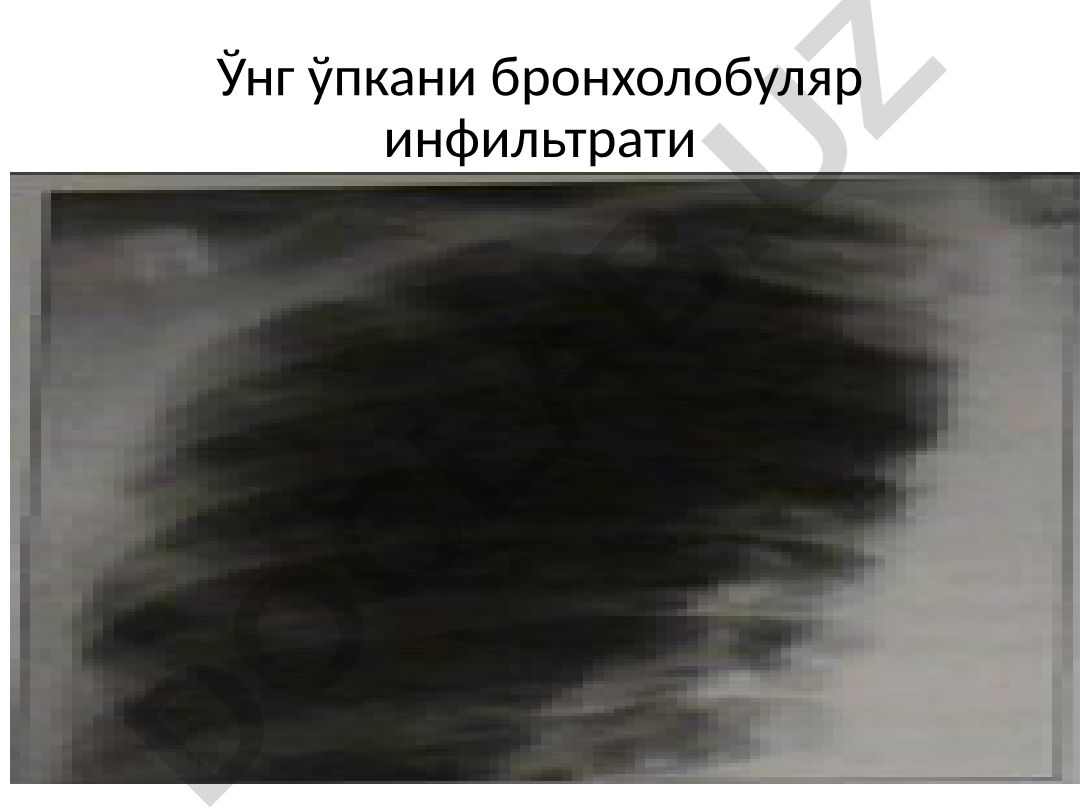 Ўнг ўпкани бронхолобуляр инфильтрати ва патологиялари