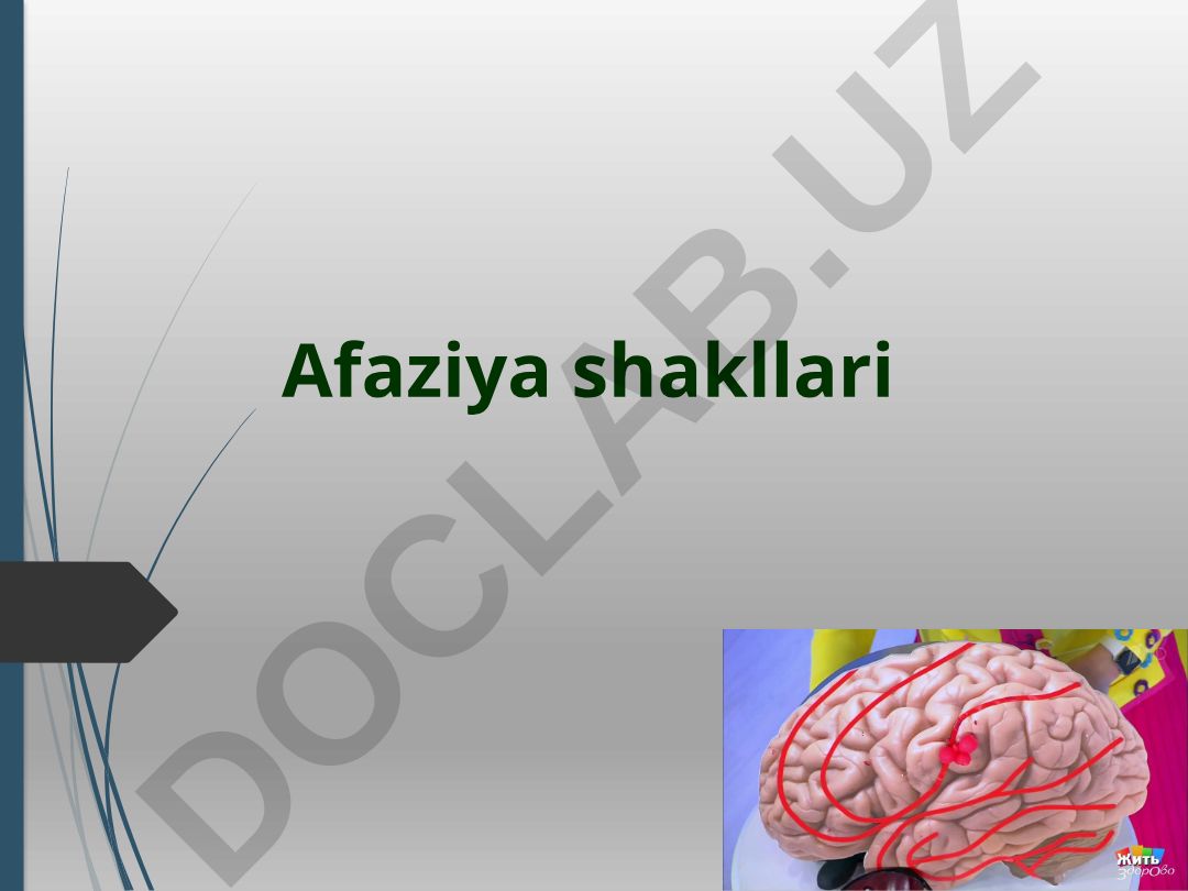 Afaziya shakllari va klassifikatsiyalari