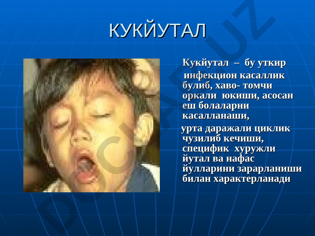 Коклюш: возбудитель, эпидемиология и клинические характеристики