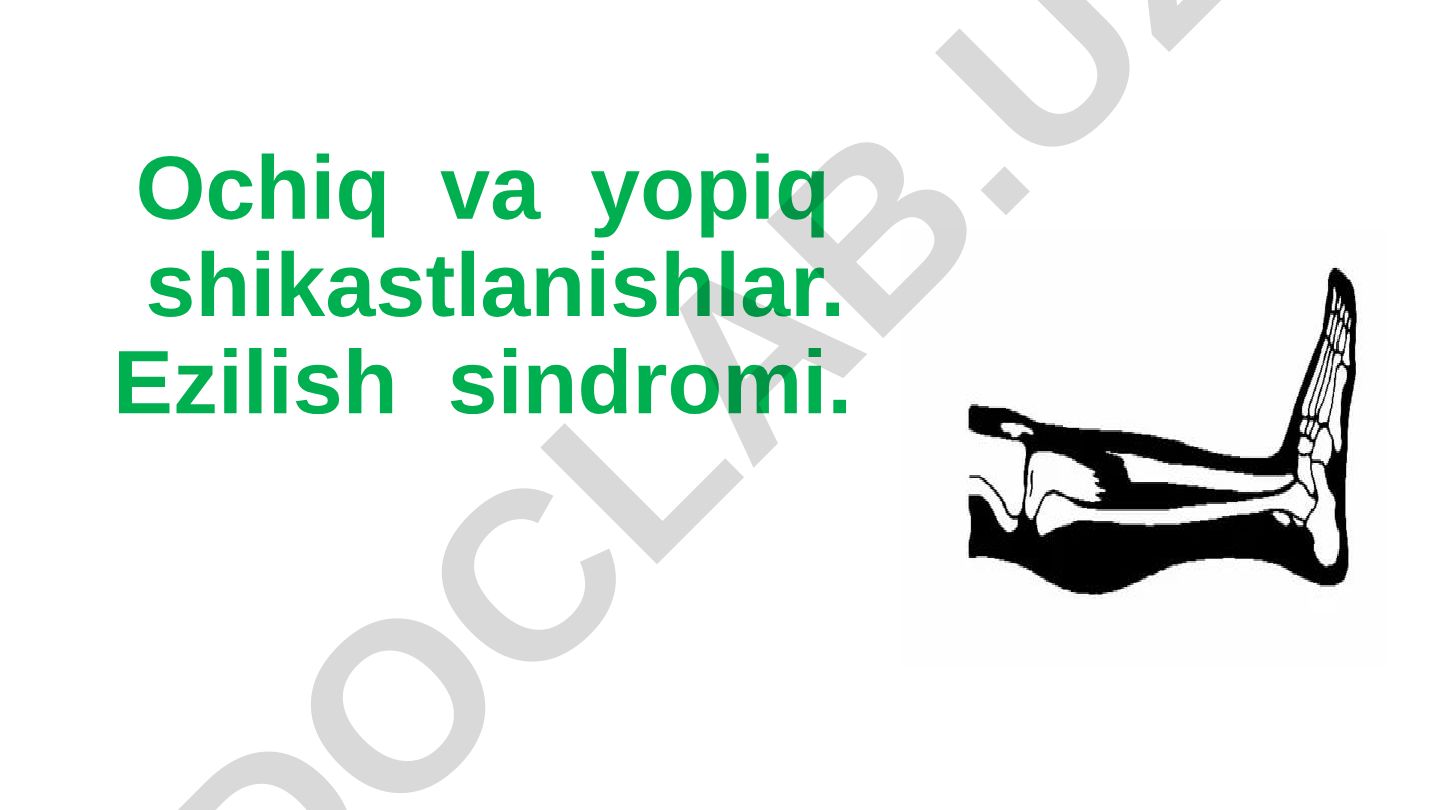 Ochiq va yopiq shikastlanishlar va ezilish sindromi